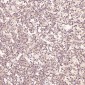 Anti-Ki67 MKI67 Rabbit Monoclonal Antibody